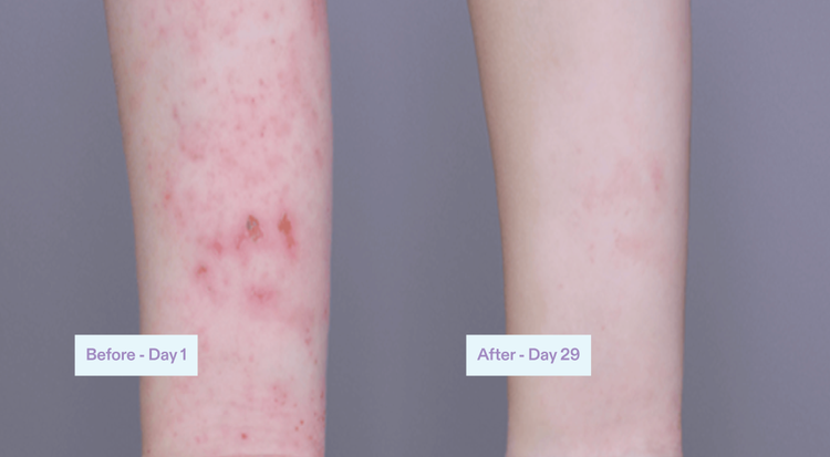 Before and after our clinical trials