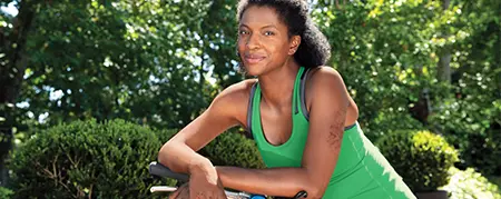 woman leaning on bicycle with eczema on arm